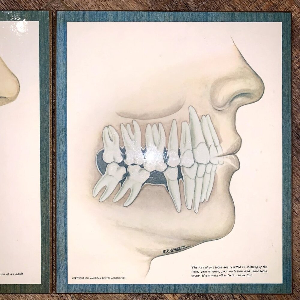 2 Lot MCM 1966 Dentist Office American Dental Association W R Schwartz TEETH ART